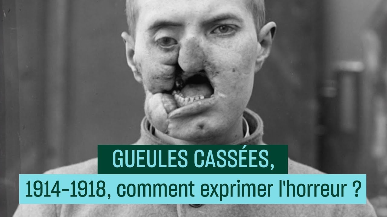 gueule cassée.jpg